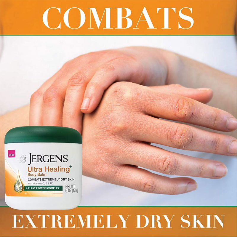 Jergens Ultra Healing Body Balm Combats Extremely Dry Skin 170g