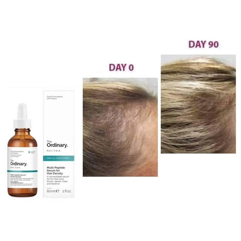 The Ordinary MultiPeptide Serum for Hair Density reviews in Hair Serum   ChickAdvisor